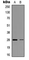 BCL2 / Bcl-2 Antibody (Internal)