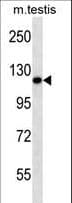 ERN2 Antibody (aa883-911)