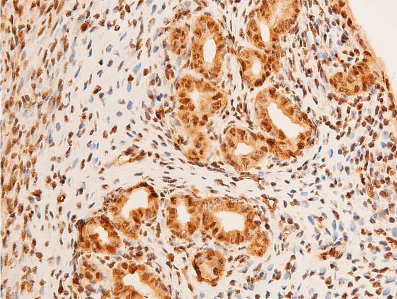Polyclonal Rabbit anti-Human JUN / c-Jun Antibody (phospho-Thr91, IHC, WB)