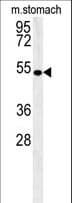 CORO6 Antibody (aa196-224)