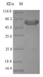 Mouse PDGF-D Protein (Recombinant 6His-SUMO, N-terminus)