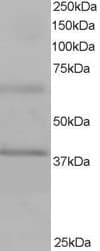IHC-plus™ Polyclonal Goat anti-Human BPOZ / ABTB1 Antibody (aa465-478, IHC, WB)