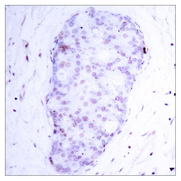 NFKB1 / NF-Kappa-B Antibody (phospho-Ser907)