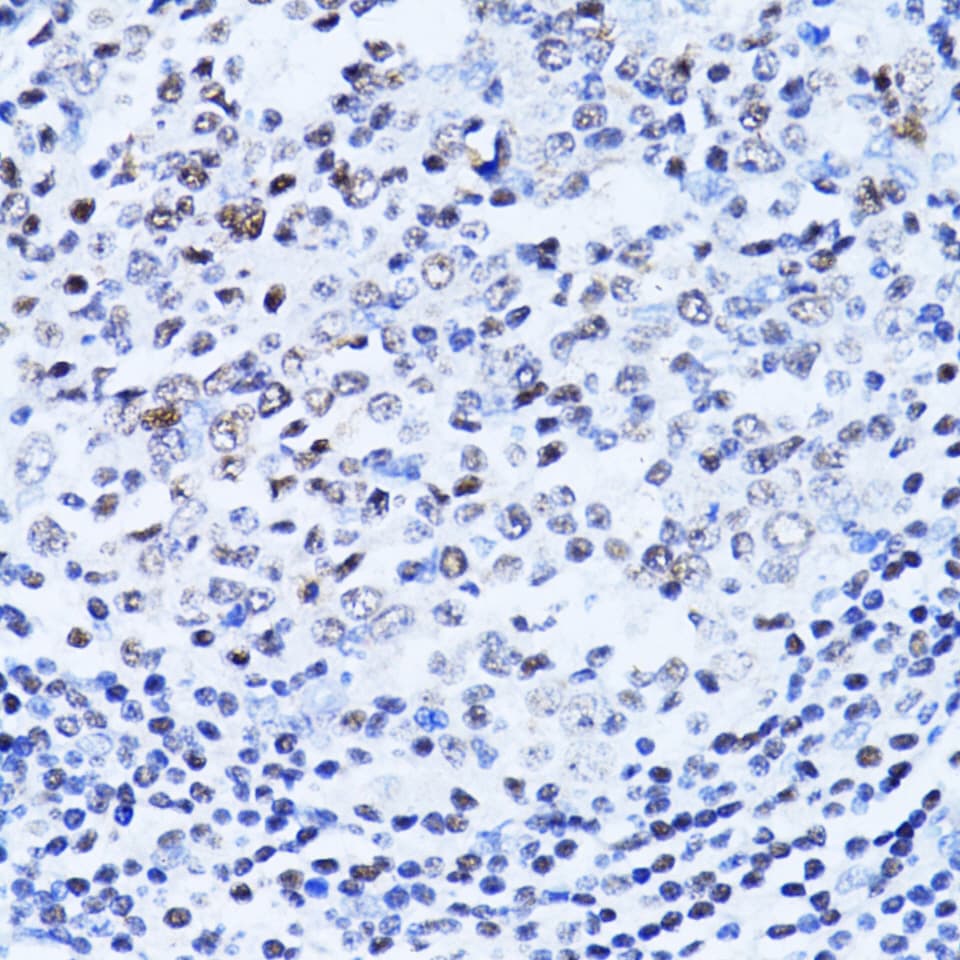 PARP1 Antibody