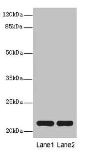 Polyclonal Rabbit anti-Human CXXC4 Antibody (IHC, WB)
