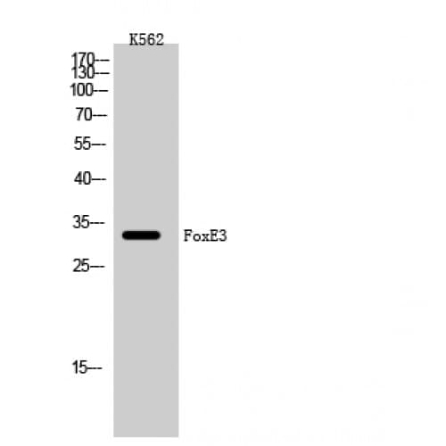 Polyclonal Rabbit anti-Human FOXE3 Antibody (50-130 aa, Internal, IHC, WB)
