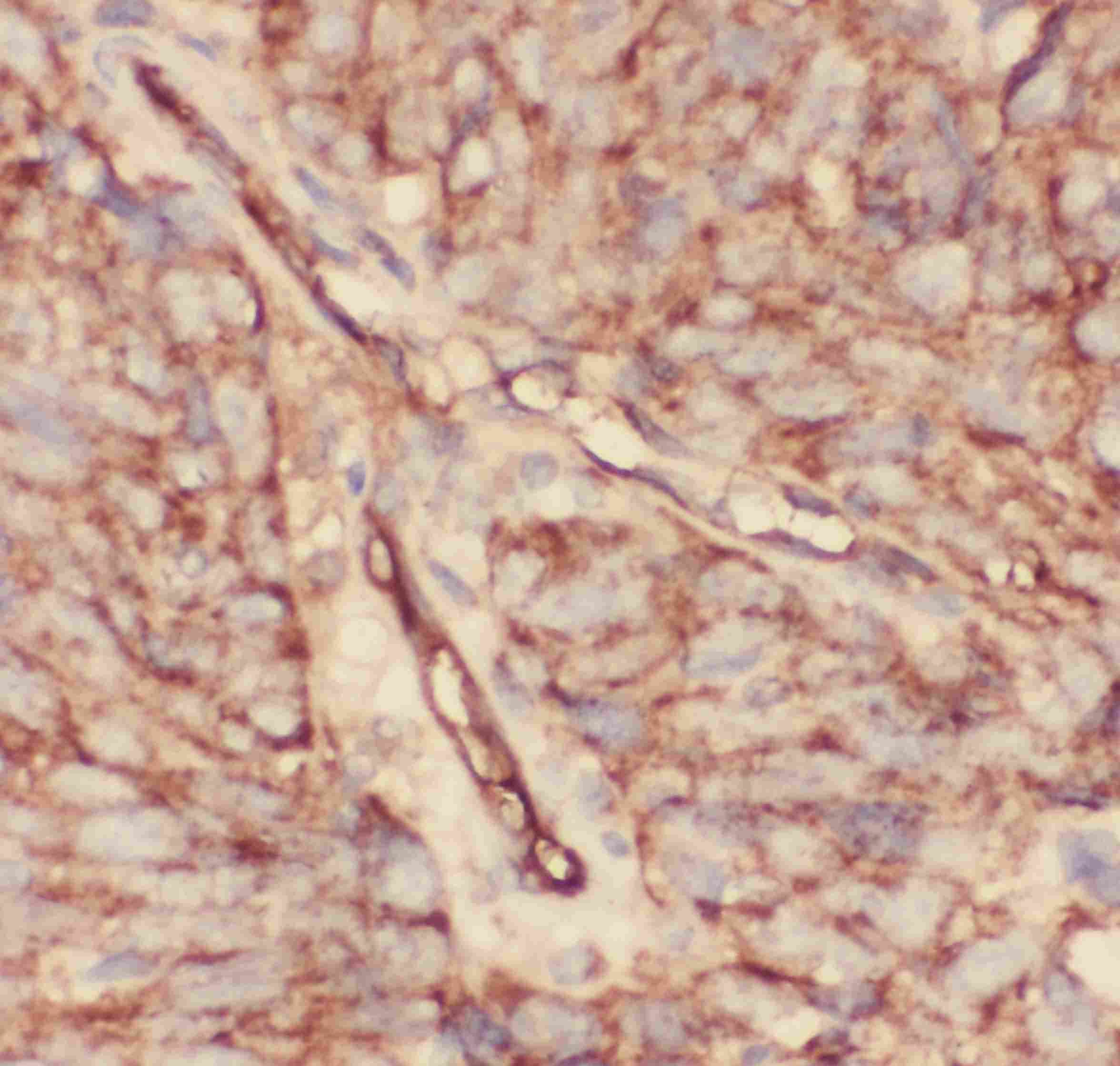 Polyclonal Rabbit anti-Human CD34 Antibody (aa151-385, IHC, WB)