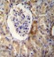 NR3C1/Glucocorticoid Receptor Antibody (aa713-742)