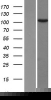 TEX10 Protein (Over-Expression Lysate Myc-DDK (Flag))