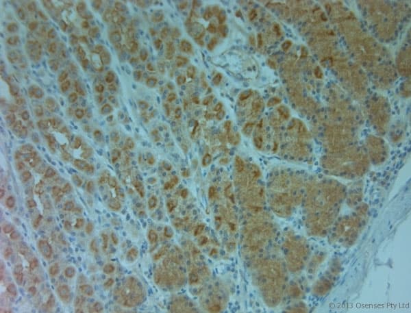 ABCC6 / MRP6 Antibody (aa825-875)