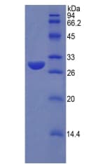 Human SUMF1 Protein (Recombinant His)