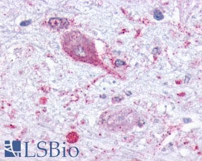 IHC-plus™ Polyclonal Rabbit anti-Human MCHR1 Antibody (N-Terminus, IHC)