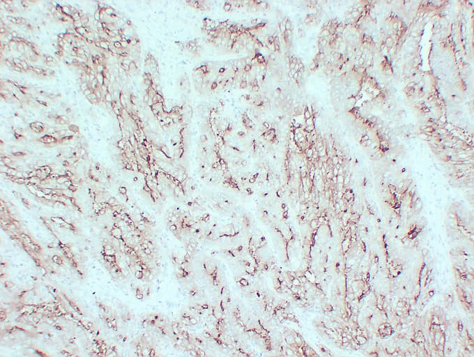 CEACAM5 / CD66e Antibody (clone ABT-CEA)