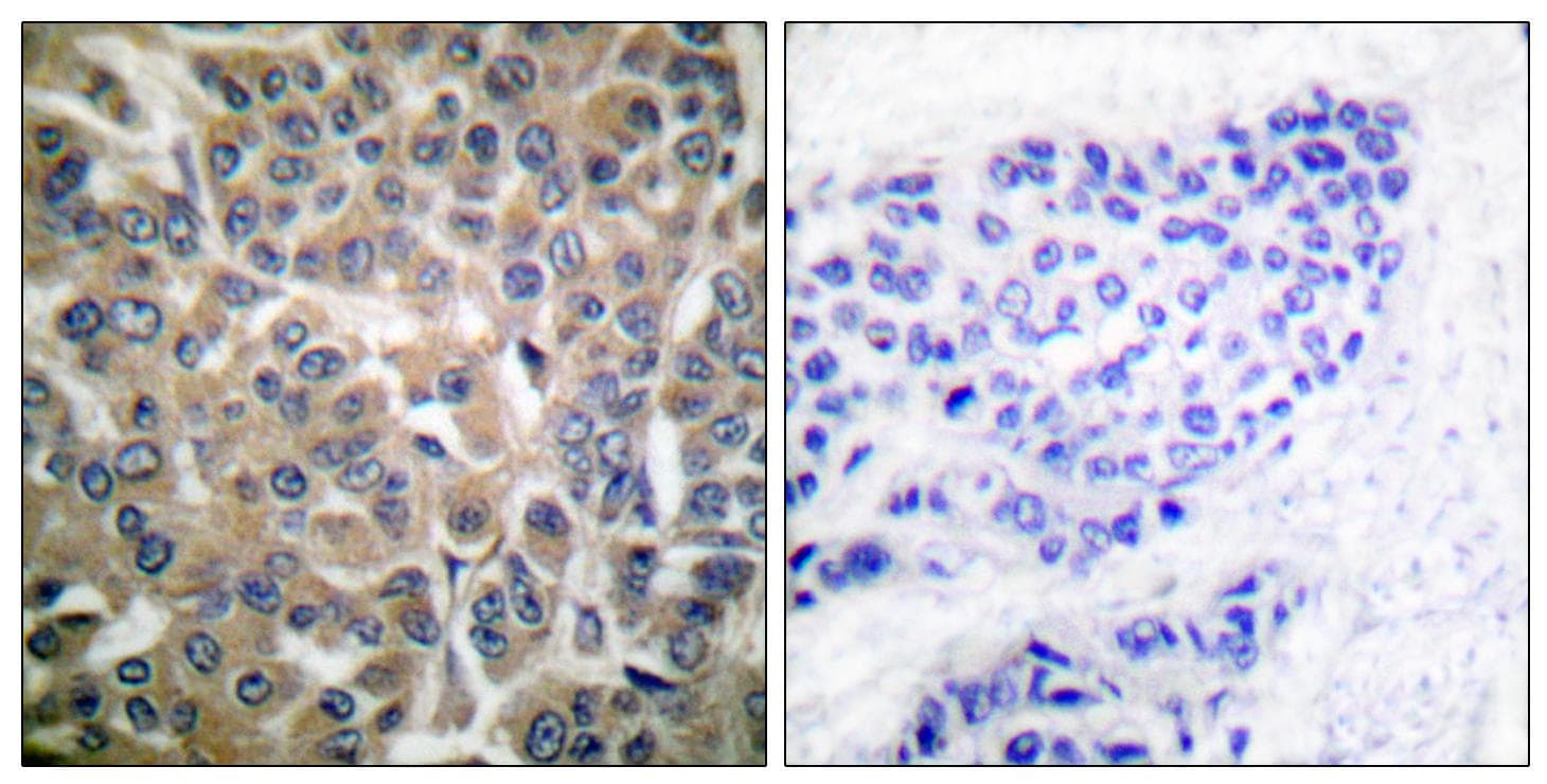 CTTN / Cortactin Antibody (p466)