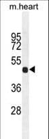 FGL2 Antibody (aa338-367)