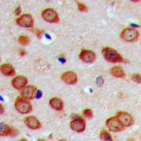 GNPAT / DHAP-AT Antibody (Internal)