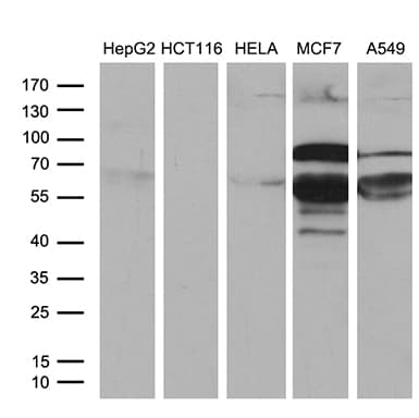 Monoclonal Mouse anti-Human PATZ1 / PATZ Antibody (clone OTI2D2, Carrier-free, WB)