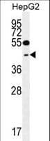 IHC-plus™ GLRX3 / Glutaredoxin 3 Antibody (aa81-110)
