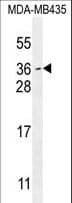 Polyclonal Rabbit anti-Human MYCT1 Antibody (aa135-163, WB)