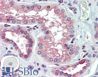 IHC-plus™ SNAI1 / SNAIL-1 Antibody (aa8-19)
