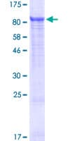Human SLC25A13 / CITRIN Protein (Recombinant GST)
