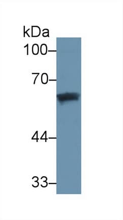 GC / Vitamin D-Binding Protein Antibody