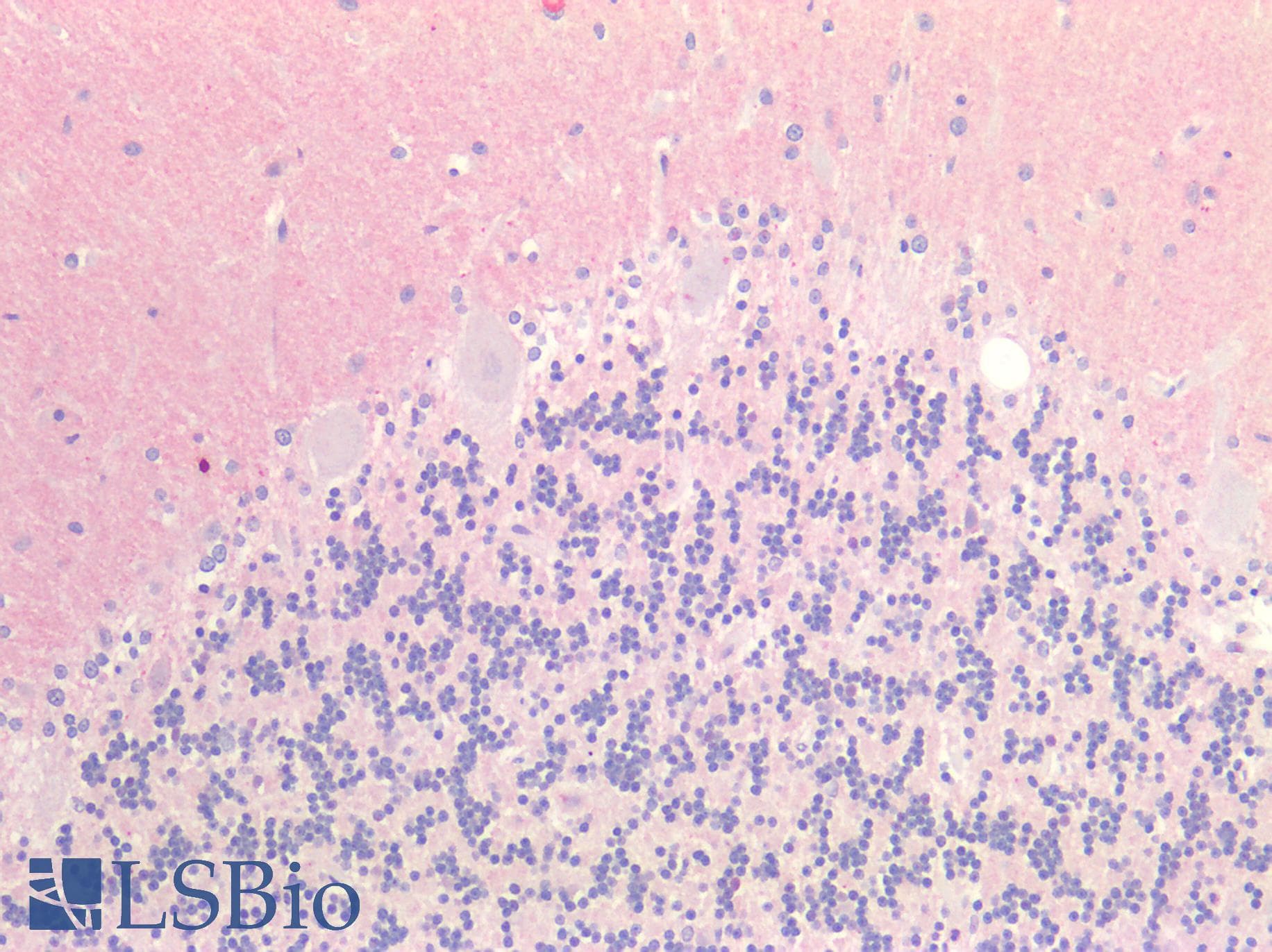 PathPlus™ Polyclonal Rabbit anti-Human GNAQ Antibody (IHC)