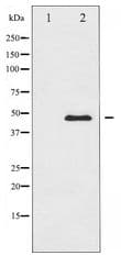 Polyclonal Rabbit anti-Human CaMKII Alpha+Delta Antibody (IHC, IF, WB)