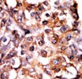 Polyclonal Rabbit anti-Human MAPKAPK2 / MAPKAP Kinase 2 Antibody (phospho-Ser272, IHC)