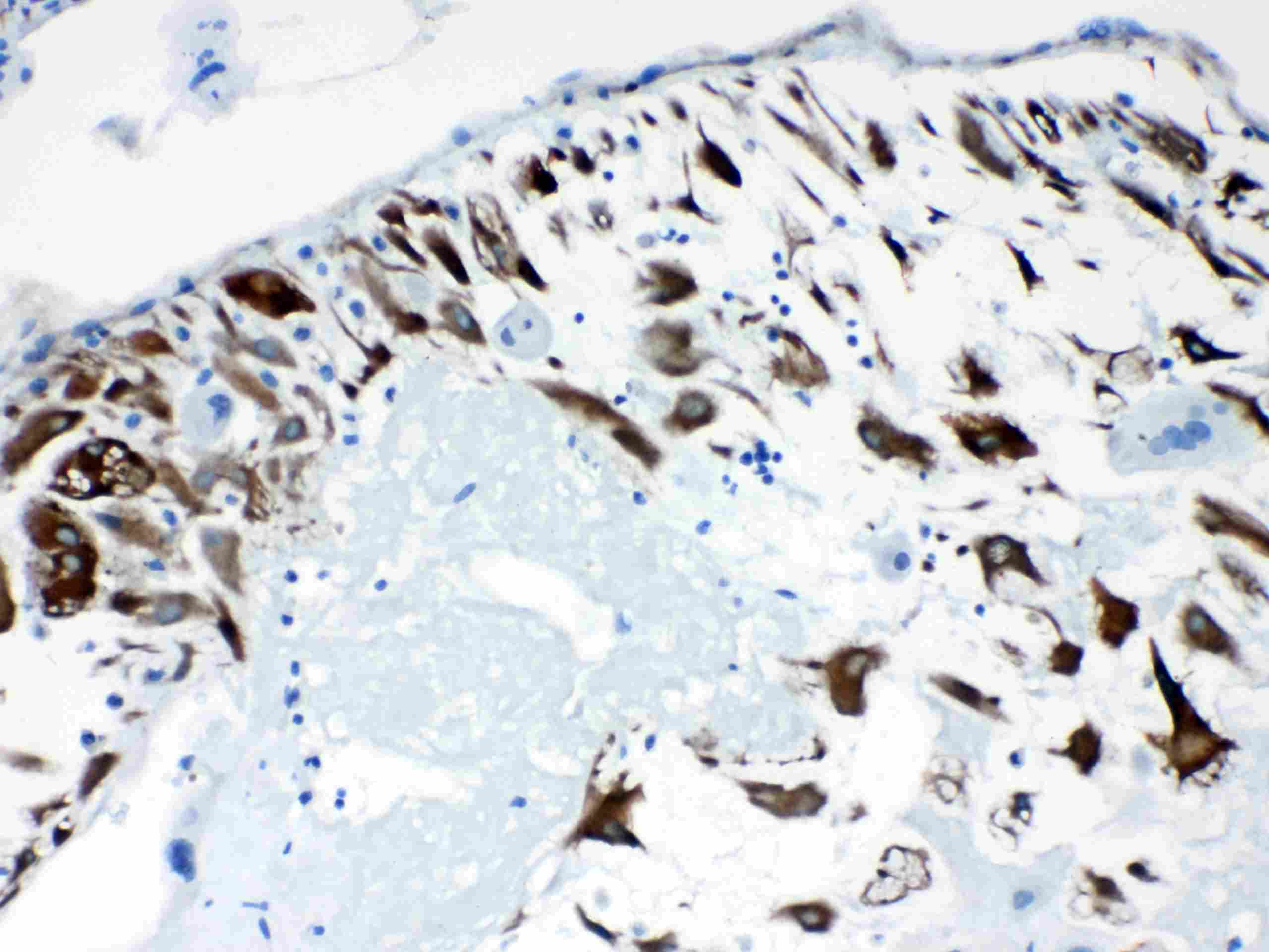 PPP1R14A / CPI-17 Antibody