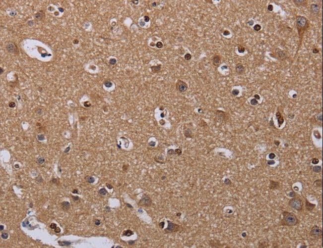 MCTS1 Antibody