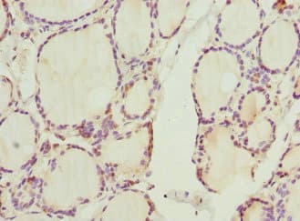 CCNE2 / Cyclin E2 Antibody