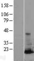 RAB31 Protein (Over-Expression Lysate Myc-DDK (Flag))