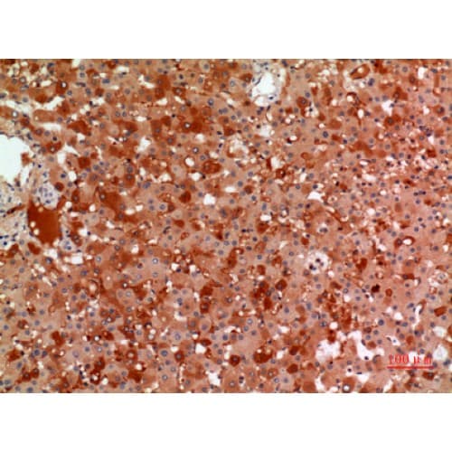 A2M / Alpha-2-Macroglobulin Antibody (Internal)