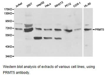 Polyclonal Rabbit anti-Human PRMT5 Antibody (IHC, WB)