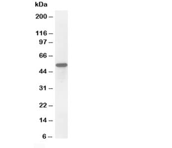 Polyclonal Rabbit anti-Human SCG3 / Secretogranin 3 Antibody (aa438-450, IHC, WB)