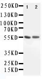 ALDH1A1 / ALDH1 Antibody (aa283-303)