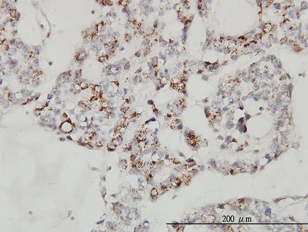 MCFD2 Antibody (clone 3A5-G4)