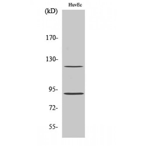 PR / Progesterone Receptor Antibody (130-210 aa)