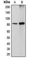 Polyclonal Rabbit anti-Human DGKA Antibody (Internal, IHC, IF, WB)
