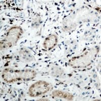 SMIF / DCP1A Antibody (Internal)