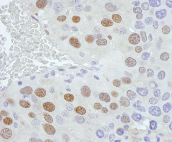 PCYT1A / CCT Alpha Antibody (aa1-50)