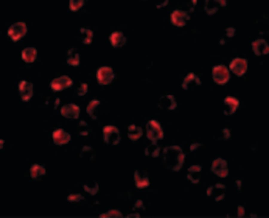 IHC-plus™ Polyclonal Rabbit anti-Human BBC3 / PUMA Antibody (IHC, IF, WB)