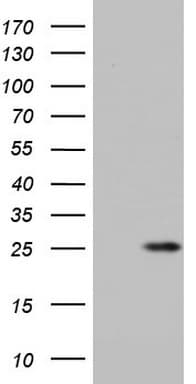 ITGB1BP1 / ICAP1 Antibody (clone OTI1D10)