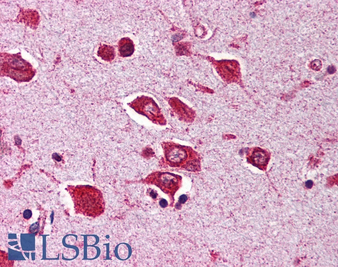 IHC-plus™ SNW1 / SKIP Antibody