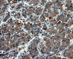 LIPG / Endothelial Lipase Antibody (clone OTI9F2, Carrier-free)