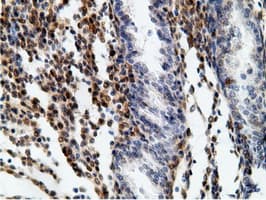 EPHX2 / Epoxide Hydrolase 2 Antibody (clone OTI1H5)