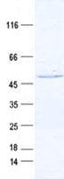 Human GSK3B / GSK3 Beta Protein (Recombinant DDK,C-terminus)