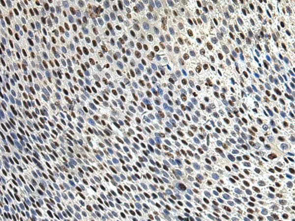 DDX39 Antibody