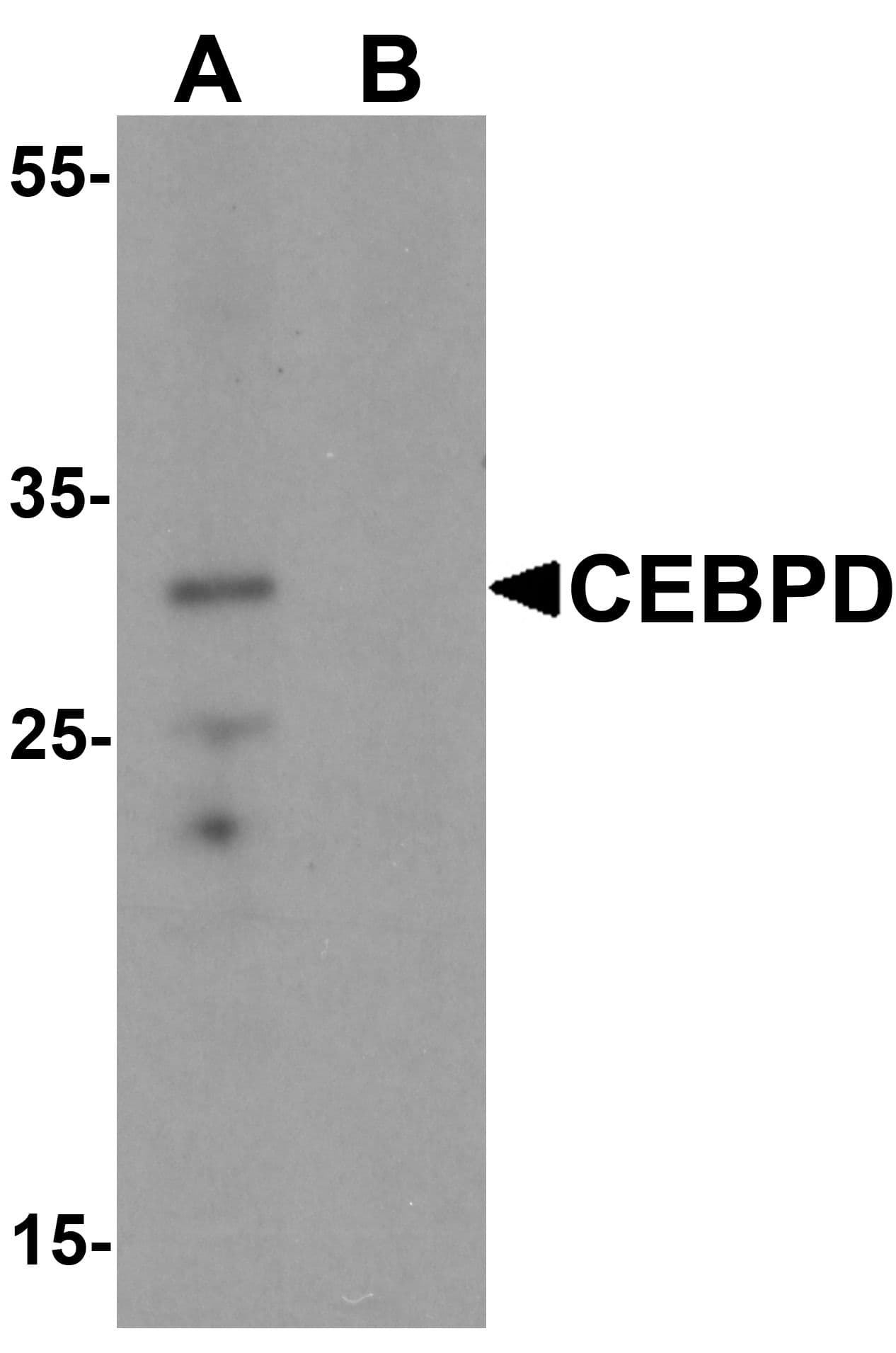 IHC-plus™ C/EBP Delta / CEBPD Antibody